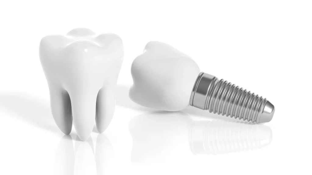 implante dental